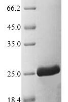Danio rerio Tnfa protein (tnfa), partial Recombinant Protein - BioCrest Sci