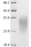 Human Platelet glycoprotein Ib beta chain (GP1BB), partial Recombinant Protein - BioCrest Sci