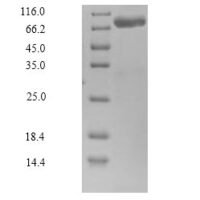 Human Calpain-14 (CAPN14), partial Recombinant Protein - BioCrest Sci