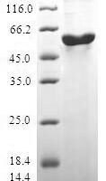 Human Protein boule-like (BOLL) Recombinant Protein, N-GST - BioCrest Sci