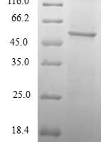 Human Transcription initiation factor TFIID subunit 11 (TAF11) Recombinant Protein - BioCrest Sci
