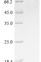 Human Protein mono-ADP-ribosyltransferase TIPARP (TIPARP) Recombinant Protein, C-His - BioCrest Sci