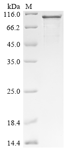 Human Protein mono-ADP-ribosyltransferase TIPARP (TIPARP) Recombinant Protein, C-His, Homo sapiens (Human), Baculovirus, C-terminal 6xHis-tagged, 79.0 kDa, purity >≥ 90% as determined by SDS-PAGE.