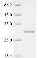 Human Protein IWS1 homolog (IWS1), partial Recombinant Protein - BioCrest Sci