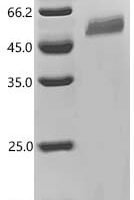 Human Early activation antigen CD69 (CD69), partial Recombinant Protein, C-mFc2a - BioCrest Sci