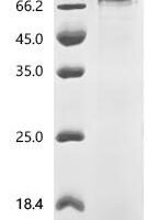 Human Signal transducer and activator of transcription 1-alpha/beta (STAT1) Recombinant Protein - BioCrest Sci