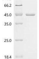 Human Synaptobrevin homolog YKT6 (YKT6) Recombinant Protein - BioCrest Sci