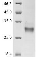 Human G-protein coupled receptor 84 (GPR84), partial Recombinant Protein - BioCrest Sci