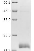 Human C-C chemokine receptor type 1 (CCR1), partial Recombinant Protein - BioCrest Sci