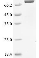 Human adenovirus F serotype 41 Hexon protein (L3), partial,Biotinylated Recombinant Protein - BioCrest Sci