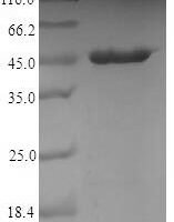 Campylobacter jejuni subsp. Major cell-binding factor (peb1A) Recombinant Protein - BioCrest Sci