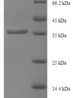 Human Intraflagellar transport protein 27 homolog (IFT27) Recombinant Protein - BioCrest Sci