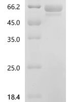 Human Adhesion G protein-coupled receptor L3 (ADGRL3), partial Recombinant Protein, N-His-SUMOstar - BioCrest Sci