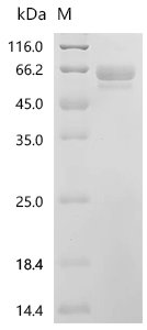 Human Adhesion G protein-coupled receptor L3 (ADGRL3), partial Recombinant Protein, N-His-SUMOstar, Homo sapiens (Human), Homo sapiens (Human), N-terminal 6xHis-sumostar-tagged, 59.4 kDa, purity >≥ 85% as determined by SDS-PAGE.