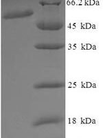Human Vacuolar fusion protein MON1 homolog A (MON1A), partial Recombinant Protein - BioCrest Sci