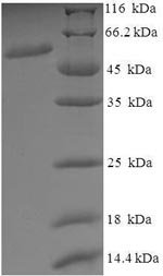 Human Vacuolar fusion protein MON1 homolog A (MON1A), partial Recombinant Protein, Homo sapiens (Human), E.coli, N-terminal 6xHis-SUMO-tagged, 56.2 kDa, purity >≥ 90% as determined by SDS-PAGE.