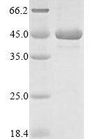 Plasmodium falciparum Merozoite surface protein 1 (MSP-1), partial Recombinant Protein - BioCrest Sci