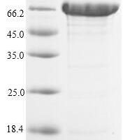 Human Acetyl-coenzyme A synthetase 2-like, mitochondrial (ACSS1) Recombinant Protein - BioCrest Sci