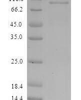 Paracoccus denitrificans Nitrous-oxide reductase (nosZ) Recombinant Protein - BioCrest Sci