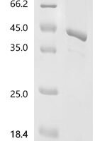 Human G1/S-specific cyclin-D2 (CCND2) Recombinant Protein, C-His - BioCrest Sci