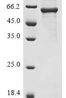 Human Syntaxin-binding protein 1 (STXBP1) Recombinant Protein - BioCrest Sci