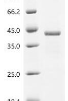Human cAMP-dependent protein kinase catalytic subunit alpha (PRKACA) Recombinant Protein - BioCrest Sci