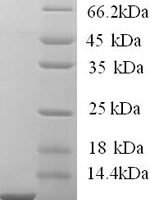 Human High affinity immunoglobulin epsilon receptor subunit gamma (FCER1G), partial Recombinant Protein - BioCrest Sci