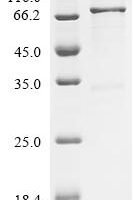 Human A disintegrin and metalloproteinase with thrombospondin motifs 18 (ADAMTS18), partial Recombinant Protein, N-10His/C-Myc - BioCrest Sci