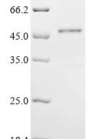 Human Ribonuclease 7 (RNASE7) Recombinant Protein, C-hFc1 - BioCrest Sci