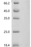 Human Alkaline phosphatase, placental type (CNKSR1) Recombinant Protein - BioCrest Sci
