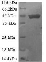 Human 40S ribosomal protein S11 (RPS11) Recombinant Protein - BioCrest Sci