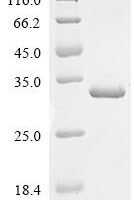 Arabidopsis thaliana Auxin-responsive protein IAA3 (IAA3) Recombinant Protein - BioCrest Sci