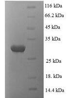 Human Proteasome subunit alpha type-1 (PSMA1), partial Recombinant Protein - BioCrest Sci