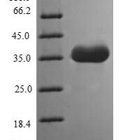 Human Tomoregulin-1 (TMEFF1), partial Recombinant Protein - BioCrest Sci