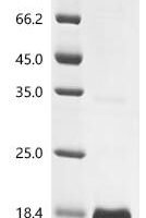 Human Serine protease inhibitor Kazal-type 9 (SPINK9) Recombinant Protein - BioCrest Sci