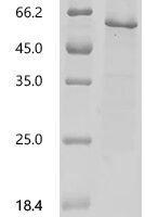 Human Bactericidal permeability-increasing protein (BPI) Recombinant Protein, C-His-Avi - BioCrest Sci