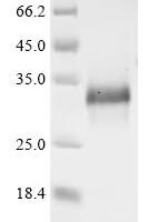 Mouse Cornifin-A (Sprr1a) Recombinant Protein - BioCrest Sci