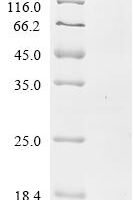 Bovine pro-epidermal growth factor (EGF), partial Recombinant Protein, C-His, aa 971–1023 - BioCrest Sci