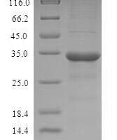Human Odorant-binding protein 2a (OBP2A) Recombinant Protein - BioCrest Sci