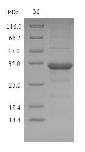 Human Odorant-binding protein 2a (OBP2A) Recombinant Protein, Homo sapiens (Human), E.coli, N-terminal 6xHis-SUMO-tagged, 33.8 kDa, purity >≥ 90% as determined by SDS-PAGE.