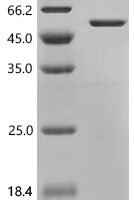 Human Cyclin-dependent kinase inhibitor 1C (CDKN1C) Recombinant Protein - BioCrest Sci