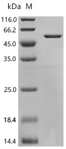 Human Cyclin-dependent kinase inhibitor 1C (CDKN1C) Recombinant Protein, Homo sapiens (Human), E.coli, C-terminal 6xHis-tagged, 39.1 kDa, purity >≥ 90% as determined by SDS-PAGE.
