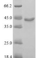 Epstein-Barr virus Latent membrane protein 1 (LMP1), partial Recombinant Protein, N-10His/C-Myc, aa 185–404 - BioCrest Sci