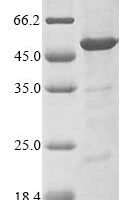 Bovine RISC-loading complex subunit TARBP2 (TARBP2) Recombinant Protein - BioCrest Sci
