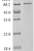Human DNA replication ATP-dependent helicase/nuclease DNA2 (DNA2), partial Recombinant Protein - BioCrest Sci
