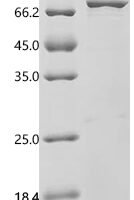 Human eIF5-mimic protein 1 (BZW2) Recombinant Protein - BioCrest Sci