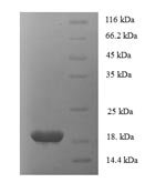 Human Tumor necrosis factor ligand superfamily member 6 (FASLG), partial Recombinant Protein, N-His, aa 130–281, E.coli - BioCrest Sci
