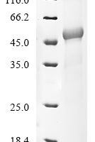 Human Low affinity immunoglobulin gamma Fc region receptor III-A (FCGR3A), partial Recombinant Protein - BioCrest Sci