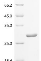 Escherichia coli Intermembrane phospholipid transport system binding protein MlaC (mlaC) Recombinant Protein, N-10His - BioCrest Sci