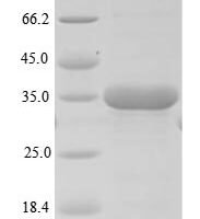 Mouse Sushi domain-containing protein 4 (Susd4), partial Recombinant Protein, N-10His - BioCrest Sci